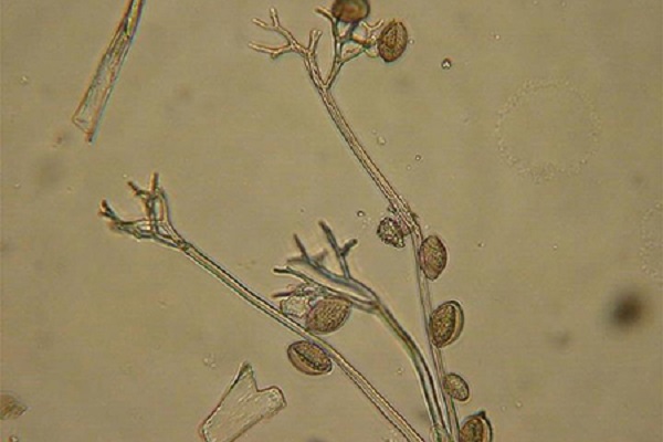 pseudoperonospora-cubensis